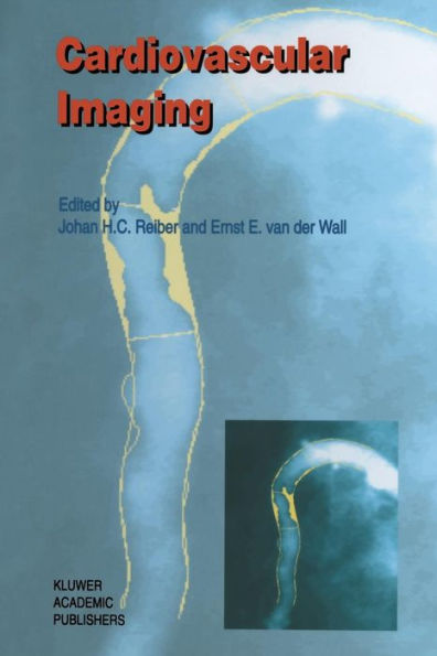 Cardiovascular Imaging