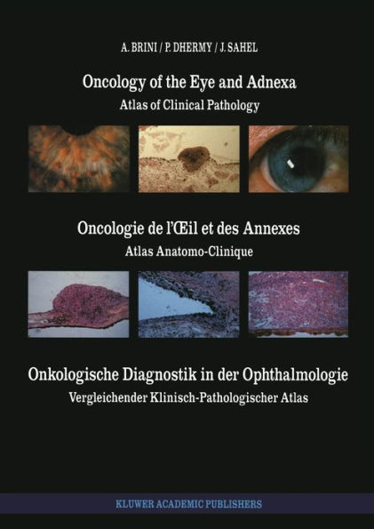 Oncology of the Eye and Adnexa / Oncologie de l'Oil et des Annexes / Onkologische Diagnostik in der Ophthalmologie: Atlas of Clinical Pathology / Atlas Anatomo-Clinique / Vergleichender Klinisch-Pathologischer Atlas