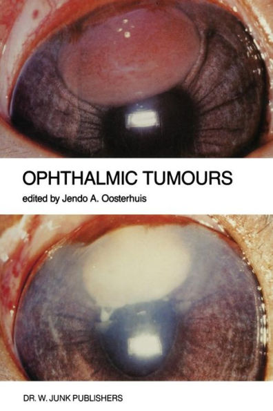 Ophthalmic Tumours: Including lectures presented at the Boerhaave Course on "Ophthalmic Tumours" of the Leiden Medical Faculty, held in Leiden, The Netherlands, on February 2-3, 1984