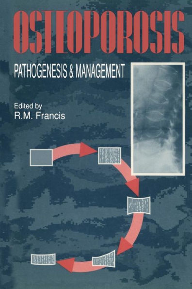 Osteoporosis: Pathogenesis and Management