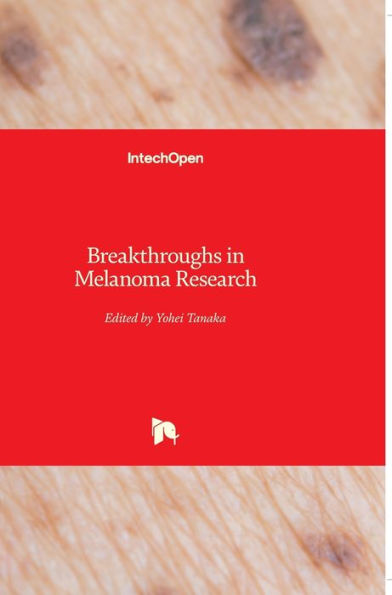 Breakthroughs in Melanoma Research