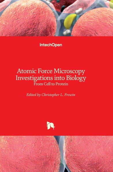 Atomic Force Microscopy Investigations into Biology: From Cell to Protein