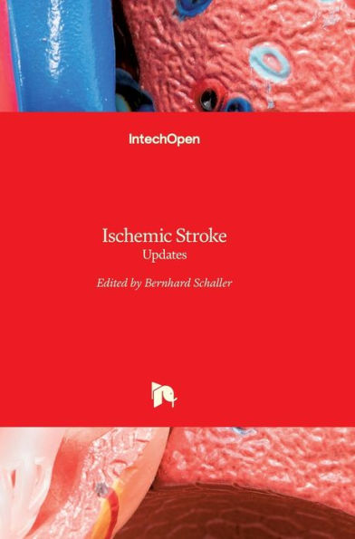 Ischemic Stroke: Updates