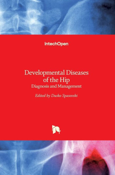 Developmental Diseases of the Hip: Diagnosis and Management