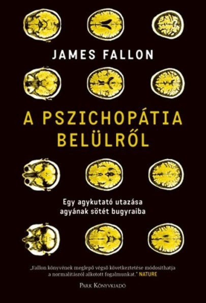 A pszichopátia belülrol: Egy agykutató utazása agyának sötét bugyraiba