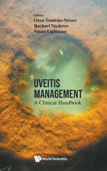 Uveitis Management: A Clinical Handbook