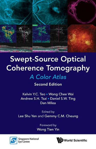 Swept-source Optical Coherence Tomography: A Color Atlas (Second Edition)