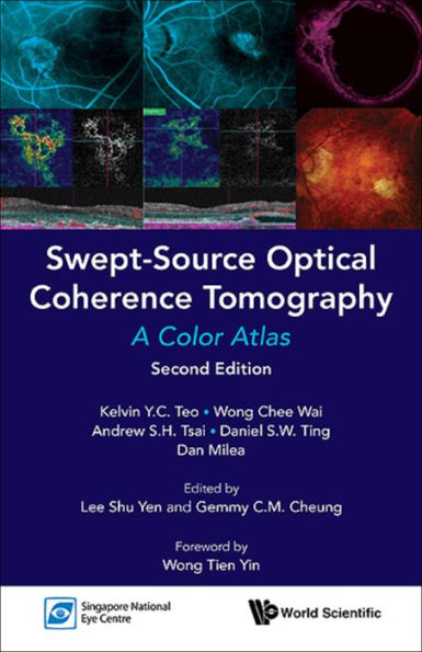 SWEPT-SOURCE OPTIC COHE (2ND ED): A Color Atlas