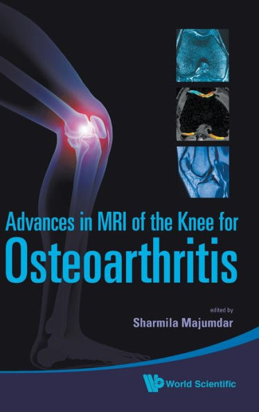 Advances In Mri Of The Knee For Osteoarthritis