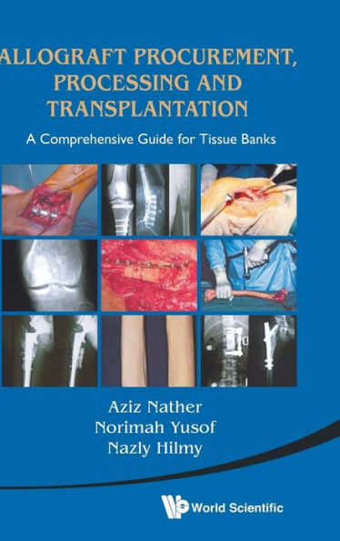 Allograft Procurement, Processing And Transplantation: A Comprehensive Guide For Tissue Banks