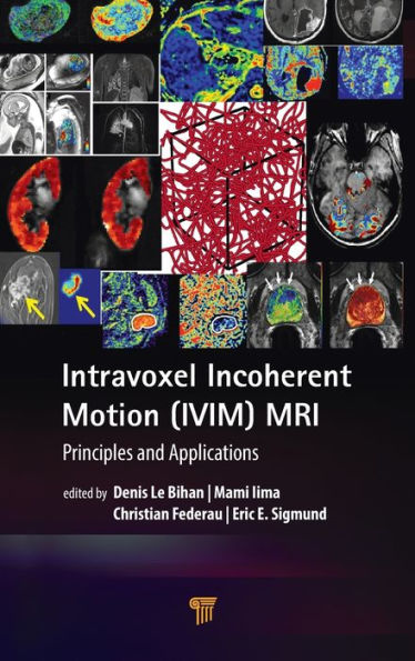 Intravoxel Incoherent Motion (IVIM) MRI: Principles and Applications / Edition 1