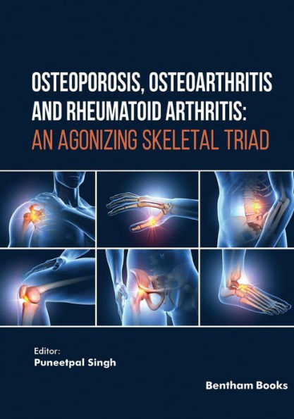 Osteoporosis, Osteoarthritis and Rheumatoid Arthritis: An Agonizing Skeletal Triad