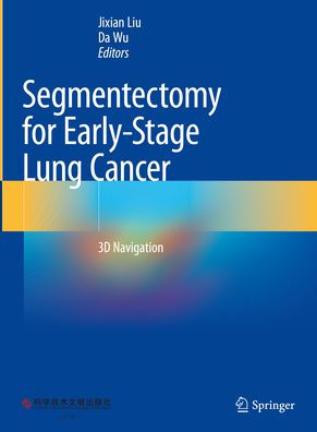 Segmentectomy for Early-Stage Lung Cancer: 3D Navigation