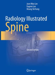 Google book pdf download Radiology Illustrated: Spine CHM FB2 9789819966110 in English by Joon Woo Lee, Eugene Lee, Heung Sik Kang