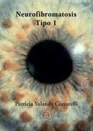 Title: Neurofibromatosis Tipo 1, Author: Patricia Yolanda Ciavarelli