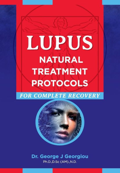 Lupus: Natural Treatment Protocols for Complete Recovery