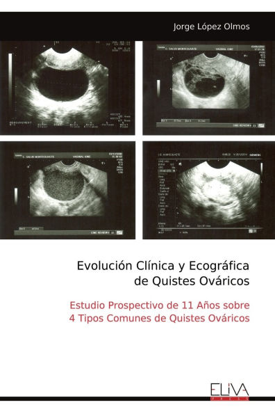 Evoluci�n Cl�nica y Ecogr�fica de Quistes Ov�ricos: Estudio Prospectivo de 11 A�os sobre 4 Tipos Comunes de Quistes Ov�ricos