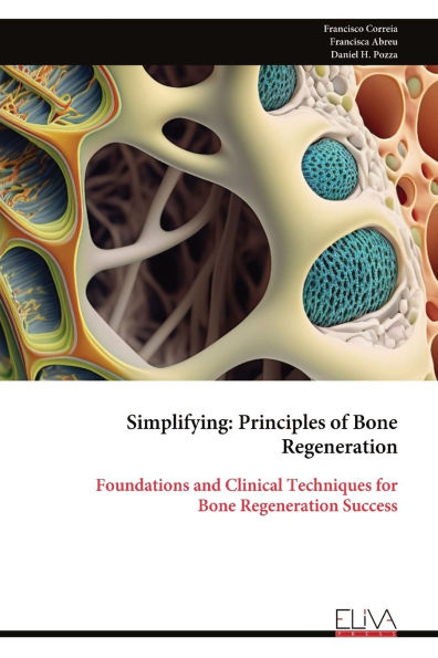 Simplifying: Principles of Bone Regeneration: Foundations and Clinical Techniques for Bone Regeneration Success