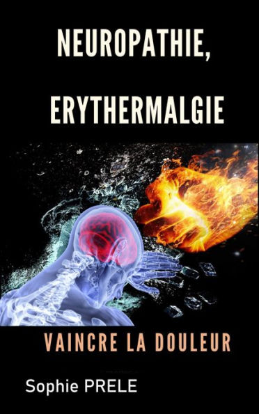 Neuropathie, érythermalgie