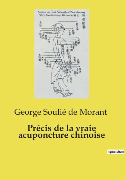 Prï¿½cis de la vraie acuponcture chinoise