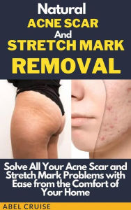 Title: Natural Acne Scar and Stretch Mark Removal: Solve All Your Acne Scar and Stretch Mark Problems with Ease from the Comfort of Your Home, Author: Cruise Abel