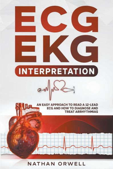 ECG/EKG Interpretation: An Easy Approach to Read a 12-Lead ECG and How Diagnose Treat Arrhythmias