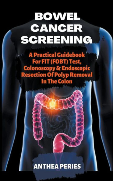 Bowel Cancer Screening: A Practical Guidebook For FIT (FOBT) Test, Colonoscopy & Endoscopic Resection Of Polyp Removal The Colon
