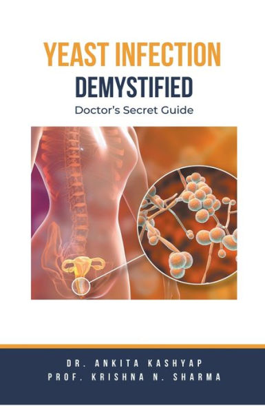 Yeast Infection: Demystified Doctor's Secret Guide