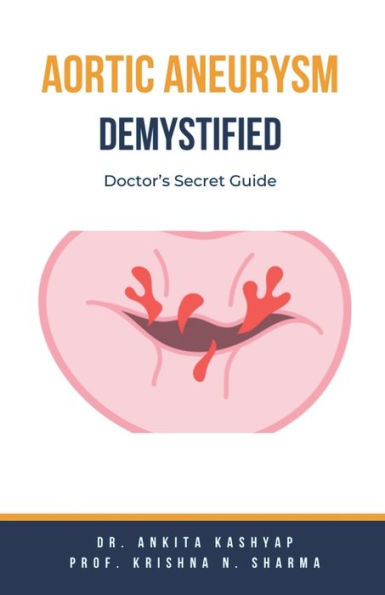 Aortic Aneurysm Demystified: Doctor's Secret Guide