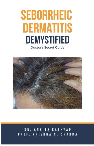 Seborrheic Dermatitis Demystified: Doctor's Secret Guide