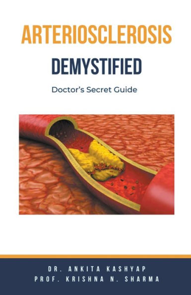 Arteriosclerosis Demystified: Doctor's Secret Guide