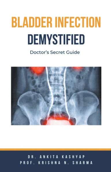 Bladder Infection Demystified: Doctor's Secret Guide
