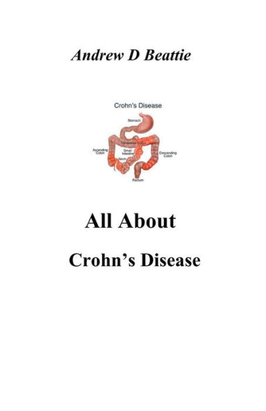 All About Crohn's Disease