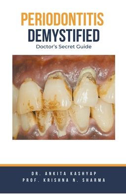 Periodontitis Demystified: Doctor's Secret Guide