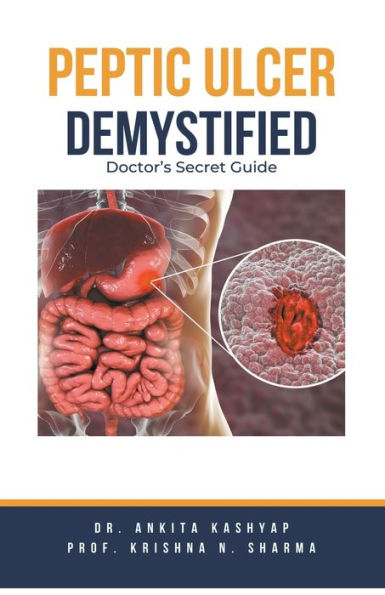 Peptic Ulcer Demystified: Doctor's Secret Guide