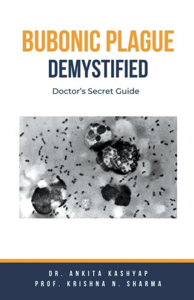 Bubonic Plague Demystified: Doctor's Secret Guide