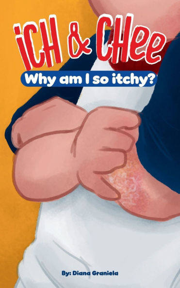 Ich & Chee: Why am I so Itchy?