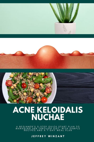 Acne Keloidalis Nuchae: a Beginner's 3-Step Quick Start Plan to Managing AKN Through Diet, With Sample Recipes and 7-Day Meal