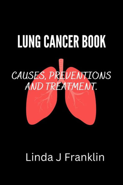 LUNG CANCER BOOK: Causes, preventions and treatment