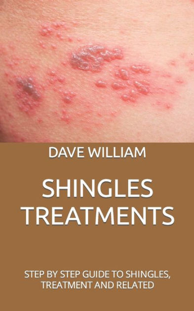 SHINGLES TREATMENTS: STEP BY STEP GUIDE TO SHINGLES, TREATMENT AND ...