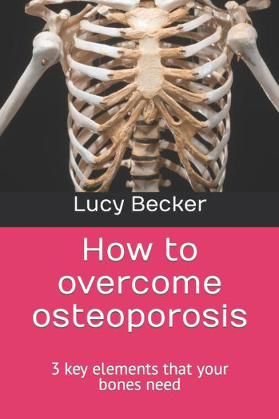 How to overcome osteoporosis: 3 key elements that your bones need