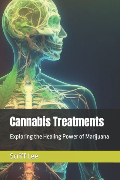 Cannabis Treatments: Exploring the Healing Power of Marijuana