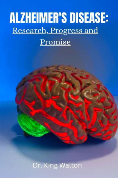 Alzheimer's Disease: : Research, Progress and Promise