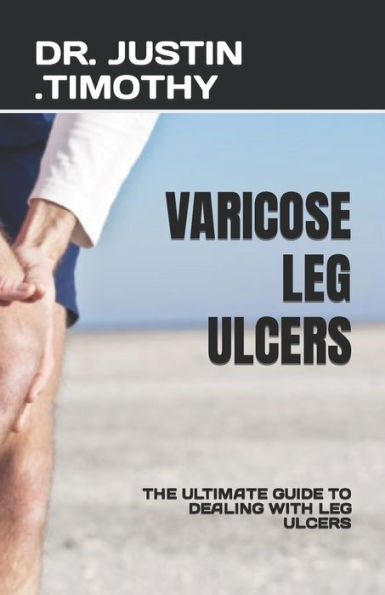 VARICOSE LEG ULCERS: THE ULTIMATE GUIDE TO DEALING WITH LEG ULCERS