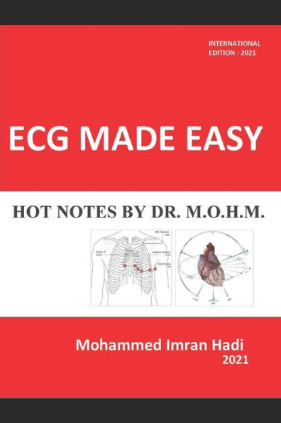 ECG MADE EASY: HOT NOTES BY DR. M.O.H.M.