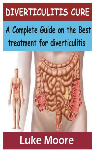 DIVERTICULITIS CURE: A Complete Guide on the Best treatment for diverticulitis
