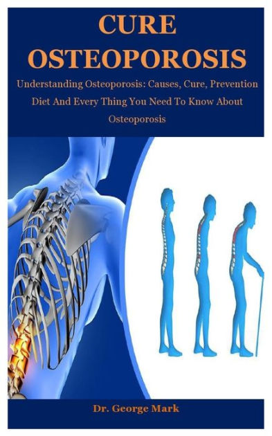 Cure Osteoporosis: Understanding Osteoporosis: Causes, Cure, Prevention ...