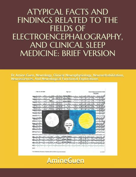 Atypical Facts and Findings Related to the Fields of Electroencephalography, and Clinical Sleep Medicine: BRIEF VERSION: Dr Amine Guen, Neurology, Clinical Neurophysiology, Neurorehabilitation, Neurosciences, And Neurological Functional Explorations