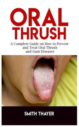 ORAL THRUSH A Complete Guide On How To Prevent And Treat Oral Thrush And Gum Diseases By SMITH