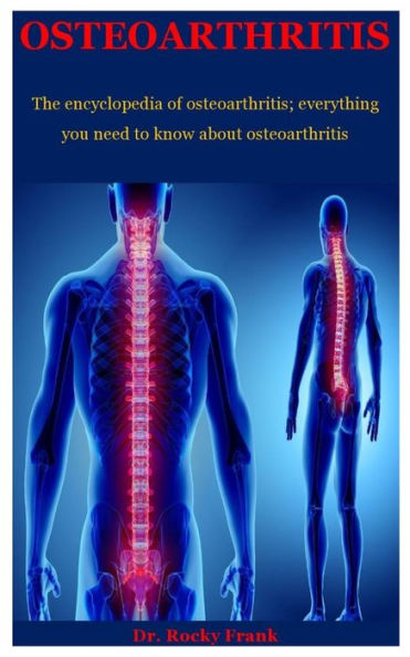 Osteoarthritis: The Encyclopedia Of Osteoarthritis; Everything You Need To Know About Osteoarthritis